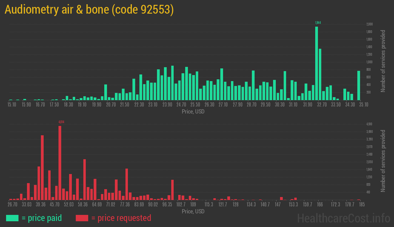 Audiometry air & bone