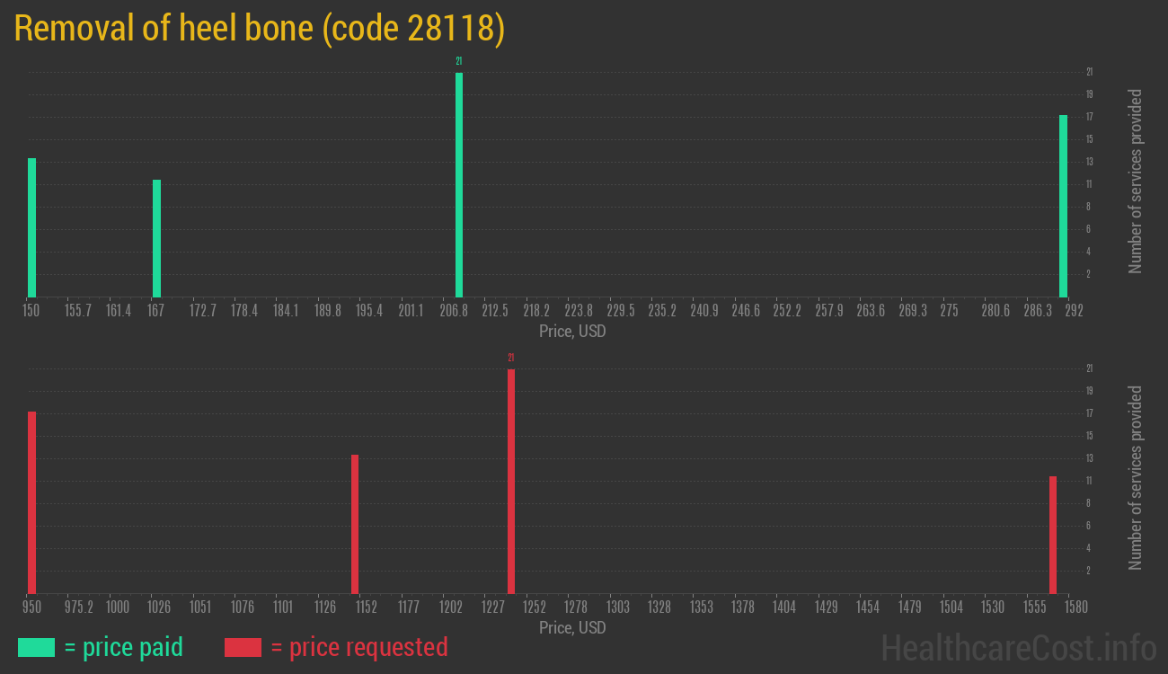 Removal of heel bone