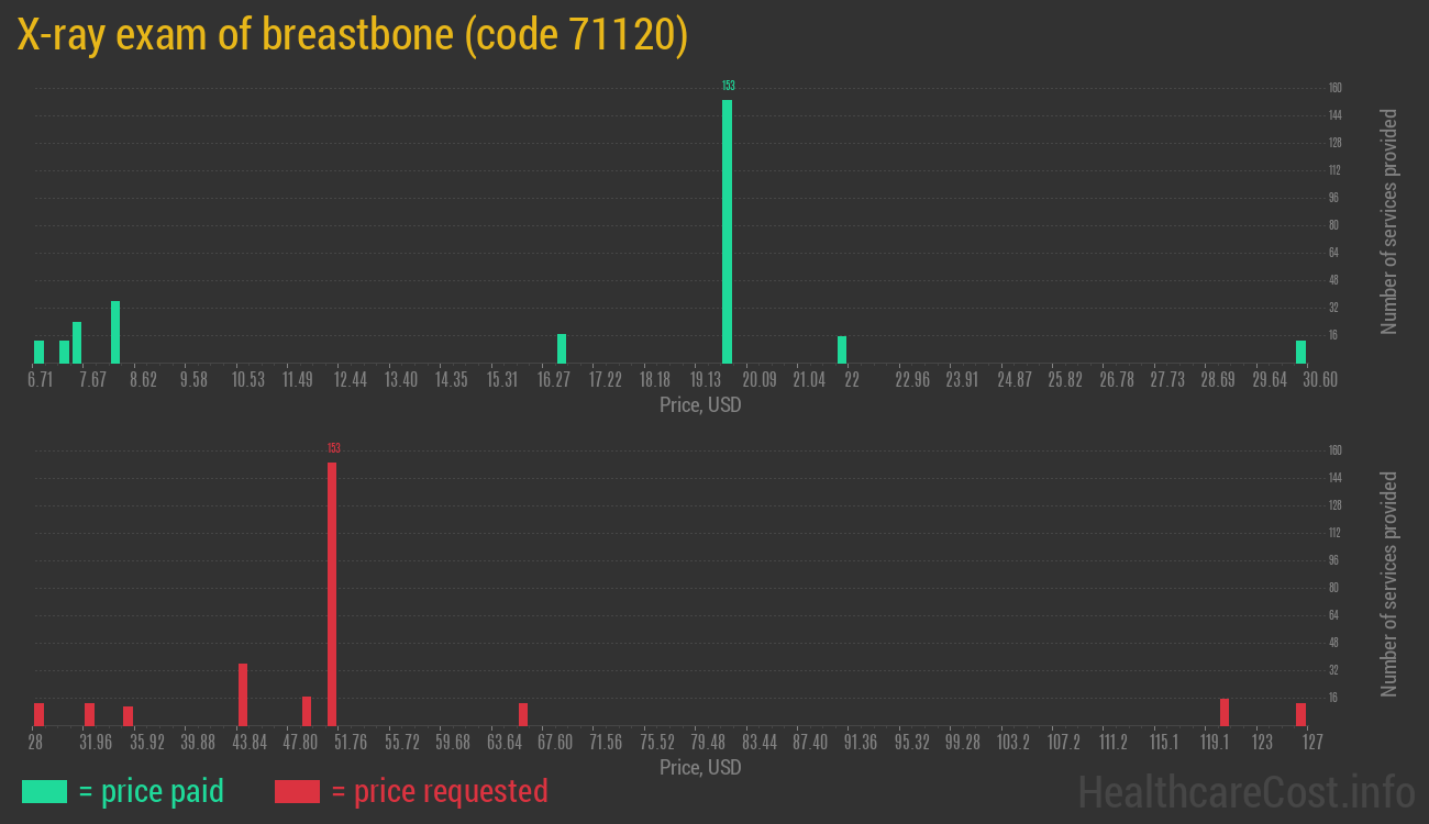 X-ray exam of breastbone